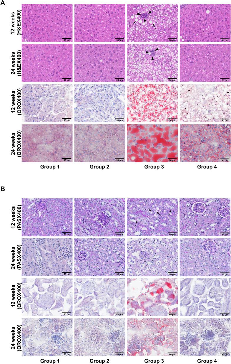 https://cdn.ncbi.nlm.nih.gov/pmc/blobs/08a2/12212437/13e4d10cd55c/IJN-20-8305-g0008.jpg
