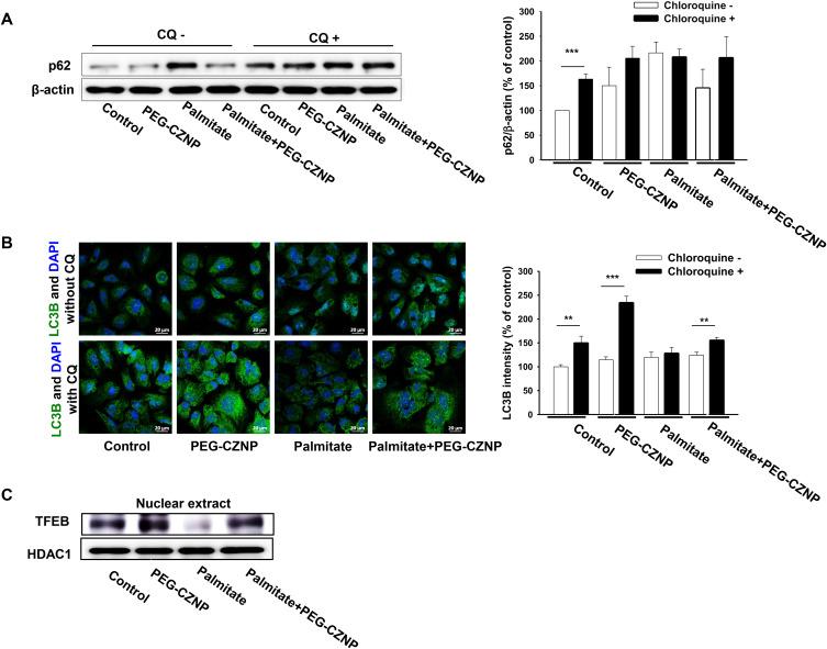https://cdn.ncbi.nlm.nih.gov/pmc/blobs/08a2/12212437/bb41b5dc8d74/IJN-20-8305-g0004.jpg