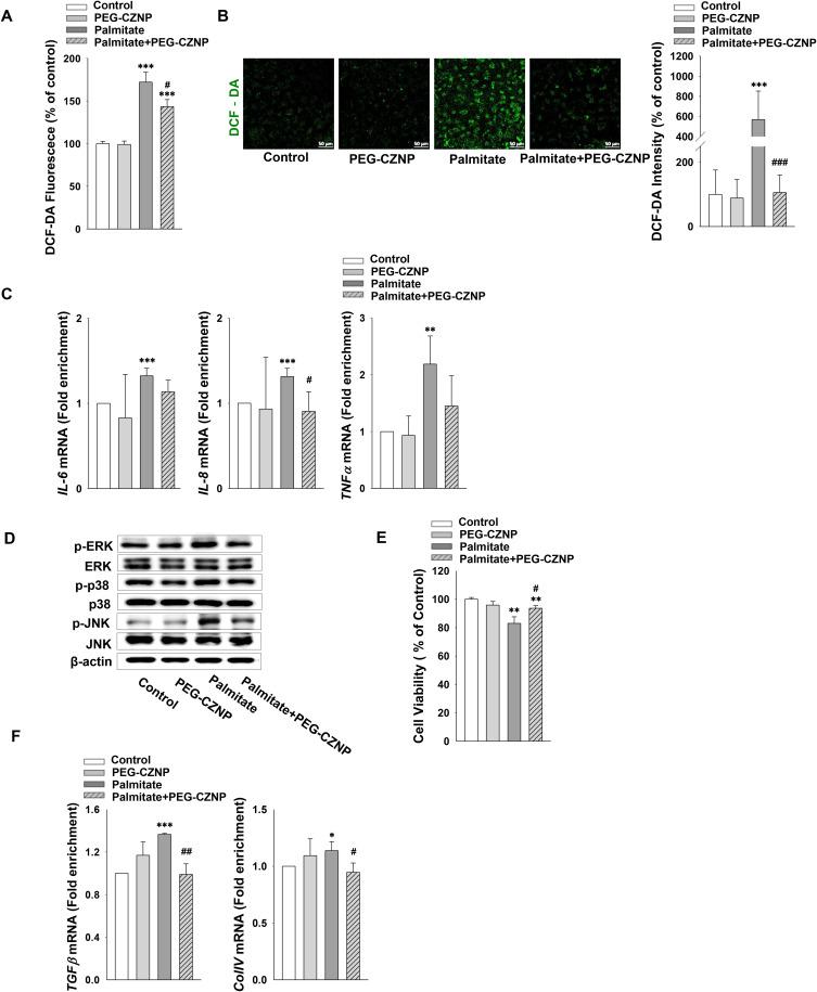 https://cdn.ncbi.nlm.nih.gov/pmc/blobs/08a2/12212437/da807c5d9e7e/IJN-20-8305-g0005.jpg