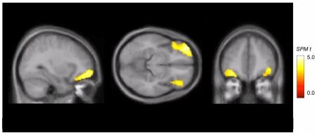 https://cdn.ncbi.nlm.nih.gov/pmc/blobs/08a8/2889822/45fee728f348/pone.0011255.g002.jpg
