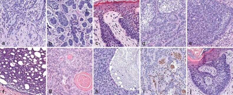 https://cdn.ncbi.nlm.nih.gov/pmc/blobs/08b0/9289702/173bd0026dab/RJME-62-4-1017-fig1.jpg