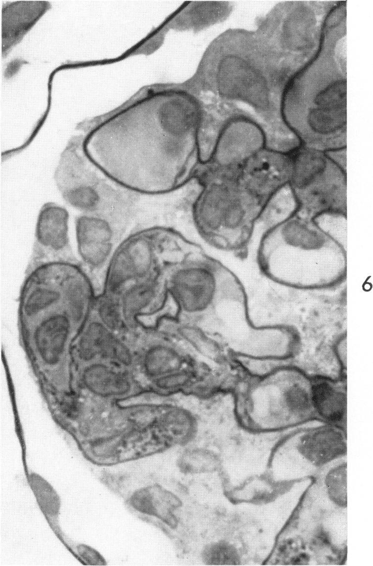https://cdn.ncbi.nlm.nih.gov/pmc/blobs/08b3/1942280/24564d06a54d/amjpathol00349-0114-b.jpg