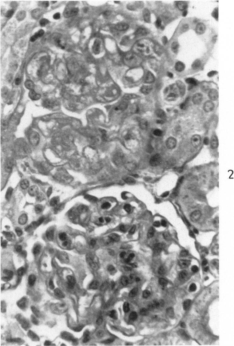 https://cdn.ncbi.nlm.nih.gov/pmc/blobs/08b3/1942280/f8080a1cf227/amjpathol00349-0112-b.jpg