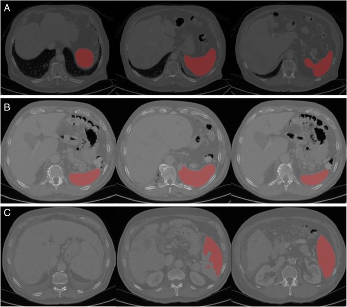 https://cdn.ncbi.nlm.nih.gov/pmc/blobs/08b7/9381627/efbd7982ba0f/330_2022_8737_Fig3_HTML.jpg