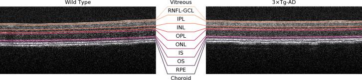 https://cdn.ncbi.nlm.nih.gov/pmc/blobs/08b8/11182266/d0d8f85a9bbb/fopht-03-1156605-g001.jpg