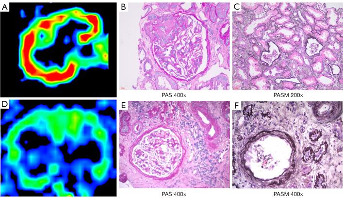 https://cdn.ncbi.nlm.nih.gov/pmc/blobs/08bd/11994526/3d8cbbab60c7/qims-15-04-3211-f4.jpg