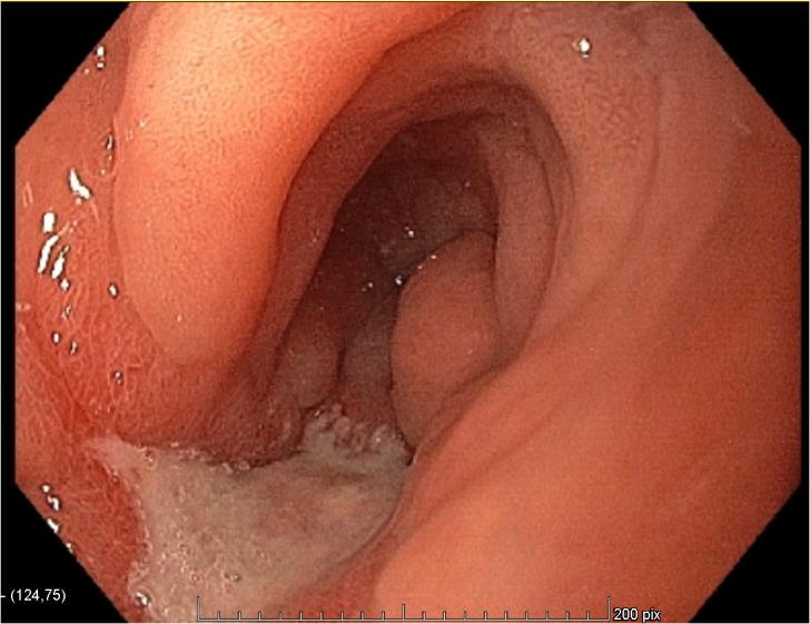 https://cdn.ncbi.nlm.nih.gov/pmc/blobs/08bf/11614720/93b89c10160f/fonc-14-1440046-g002.jpg