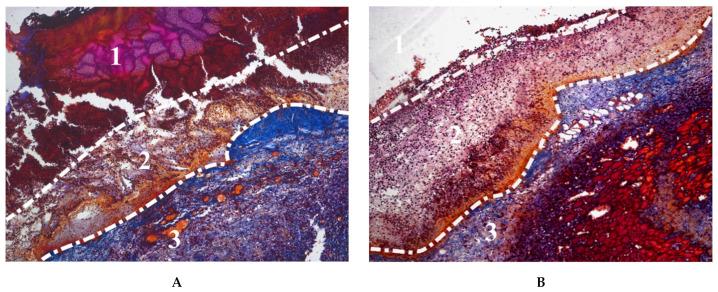 https://cdn.ncbi.nlm.nih.gov/pmc/blobs/08c1/8293244/458972404c83/gels-07-00079-g005.jpg