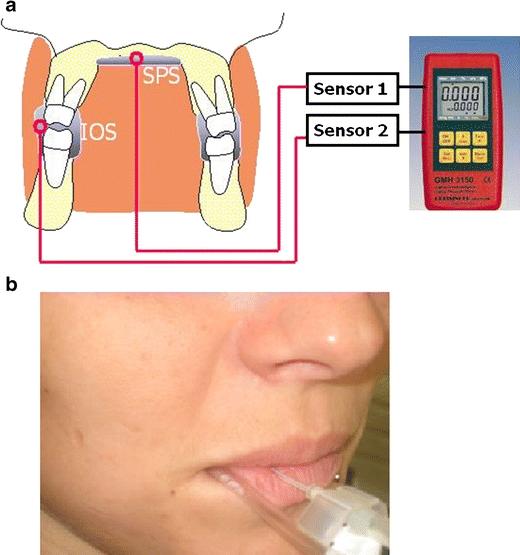 https://cdn.ncbi.nlm.nih.gov/pmc/blobs/08c3/3056003/33d2657fac55/784_2009_367_Fig6_HTML.jpg