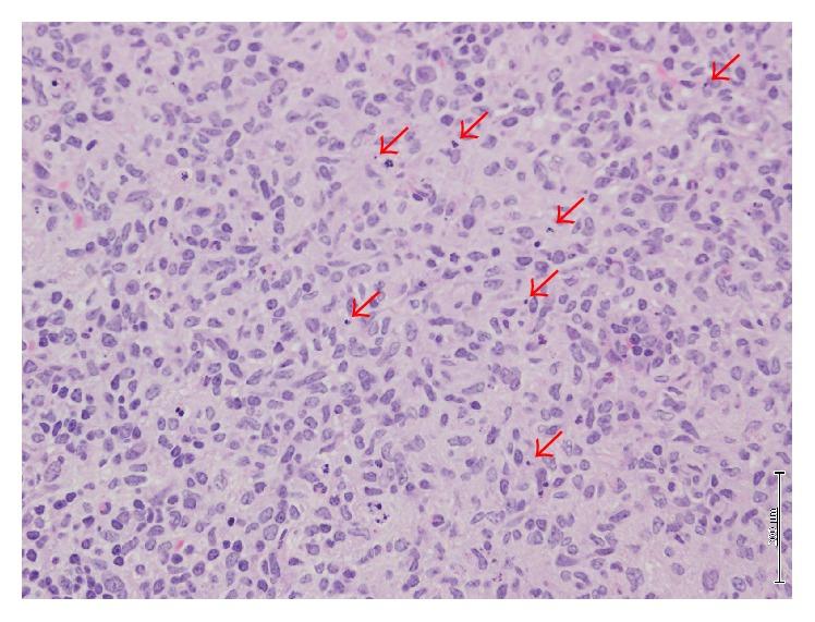 https://cdn.ncbi.nlm.nih.gov/pmc/blobs/08c7/5394349/adee18b44983/BMRI2017-7412865.003.jpg