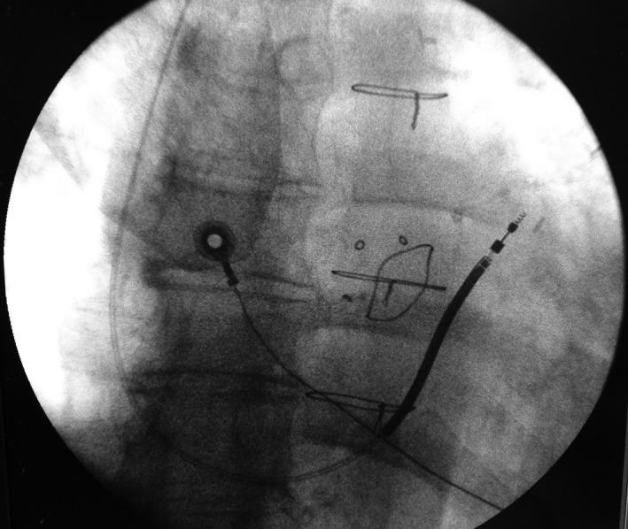 https://cdn.ncbi.nlm.nih.gov/pmc/blobs/08c8/6595376/7276d36f026e/JOA3-35-562-g002.jpg