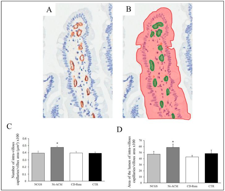 https://cdn.ncbi.nlm.nih.gov/pmc/blobs/08cb/10222428/845b00e5ea89/nutrients-15-02353-g007.jpg