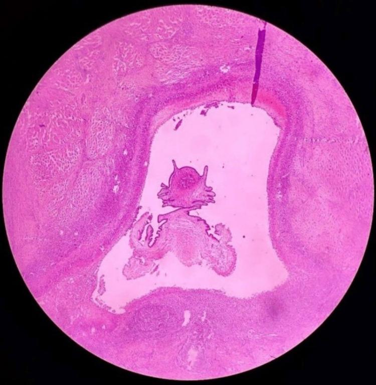 https://cdn.ncbi.nlm.nih.gov/pmc/blobs/08d1/11211646/be269998f417/cureus-0016-00000061275-i05.jpg
