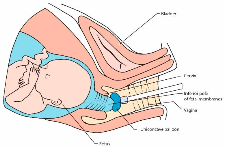 https://cdn.ncbi.nlm.nih.gov/pmc/blobs/08d3/8003203/a5acb0815b42/jcm-10-01270-g003.jpg