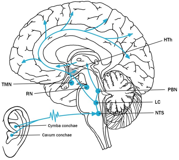 https://cdn.ncbi.nlm.nih.gov/pmc/blobs/08dd/12174914/bd36f7ee1187/NSS-17-1327-g0002.jpg