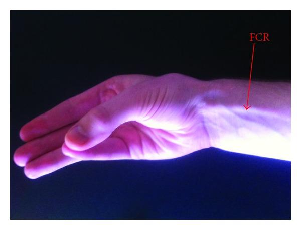 https://cdn.ncbi.nlm.nih.gov/pmc/blobs/08e2/3503284/c703f4071930/PSI2012-282959.001.jpg