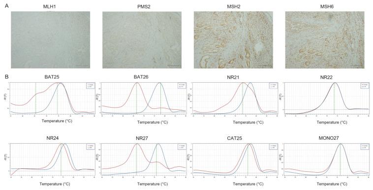 https://cdn.ncbi.nlm.nih.gov/pmc/blobs/08e3/9102010/0090e9e70d38/cancers-14-02204-g001.jpg