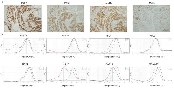https://cdn.ncbi.nlm.nih.gov/pmc/blobs/08e3/9102010/0fed3db8314f/cancers-14-02204-g003.jpg
