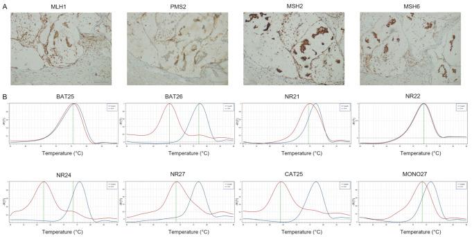 https://cdn.ncbi.nlm.nih.gov/pmc/blobs/08e3/9102010/13a55cd2b294/cancers-14-02204-g005.jpg
