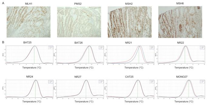 https://cdn.ncbi.nlm.nih.gov/pmc/blobs/08e3/9102010/8f121f9004f1/cancers-14-02204-g004.jpg