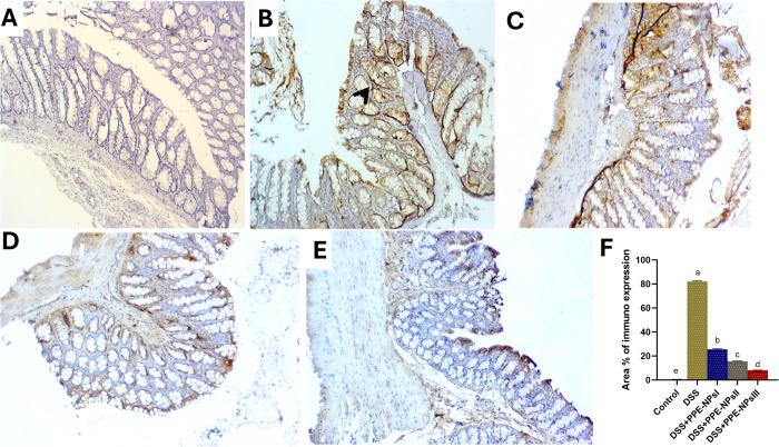 https://cdn.ncbi.nlm.nih.gov/pmc/blobs/08e9/12074350/dff11e1017a2/pone.0323605.g009.jpg