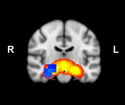 https://cdn.ncbi.nlm.nih.gov/pmc/blobs/08f3/6869708/01efcf60d660/HBM-36-2387-g003.jpg