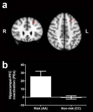 https://cdn.ncbi.nlm.nih.gov/pmc/blobs/08f3/6869708/b48eb15e2a5b/HBM-36-2387-g002.jpg