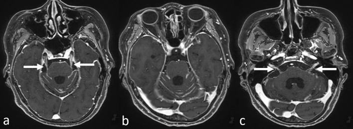 https://cdn.ncbi.nlm.nih.gov/pmc/blobs/08f6/10066091/159ea3d51b2e/11604_2022_1362_Fig5_HTML.jpg