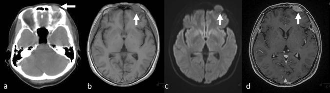 https://cdn.ncbi.nlm.nih.gov/pmc/blobs/08f6/10066091/a2690c0edf5f/11604_2022_1362_Fig1_HTML.jpg