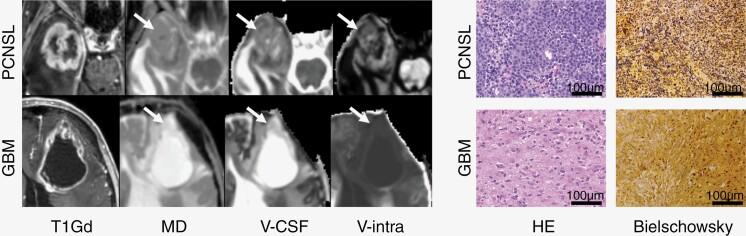 https://cdn.ncbi.nlm.nih.gov/pmc/blobs/08f7/11214103/3ba73ba3fd22/vdae093_fig4.jpg