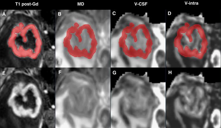 https://cdn.ncbi.nlm.nih.gov/pmc/blobs/08f7/11214103/b3de6f22f737/vdae093_fig1.jpg
