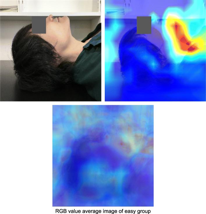 https://cdn.ncbi.nlm.nih.gov/pmc/blobs/08f9/8101256/f19f71db2b7e/40560_2021_551_Fig8_HTML.jpg