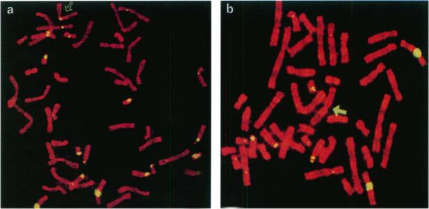 https://cdn.ncbi.nlm.nih.gov/pmc/blobs/0910/1915107/d45659dddc0d/ajhg00020-0177-a.jpg