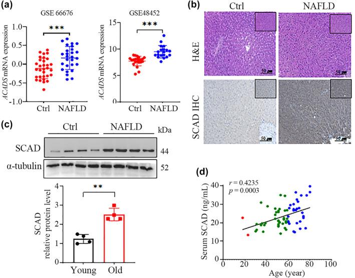 https://cdn.ncbi.nlm.nih.gov/pmc/blobs/0911/11464120/70fe5314bfdc/ACEL-23-e14256-g002.jpg