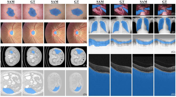 https://cdn.ncbi.nlm.nih.gov/pmc/blobs/0913/10252742/336527d821f0/diagnostics-13-01947-g001.jpg