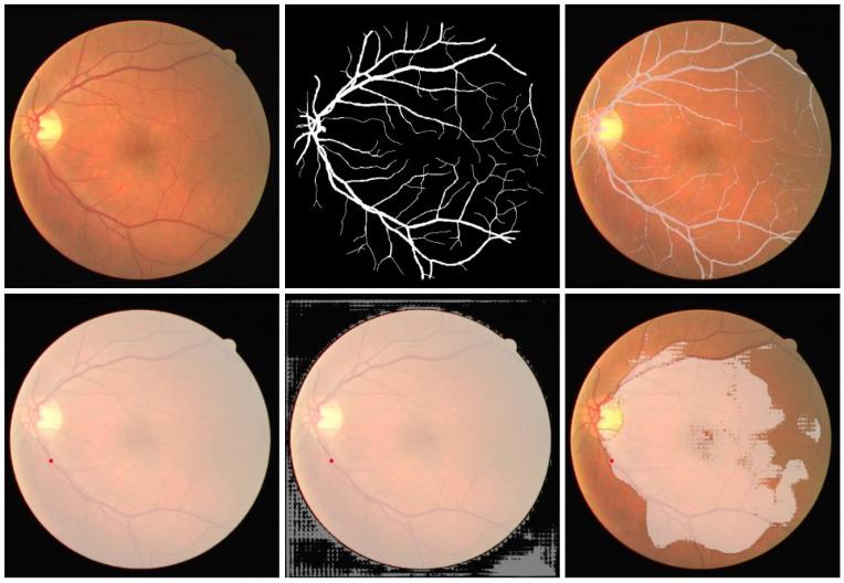 https://cdn.ncbi.nlm.nih.gov/pmc/blobs/0913/10252742/678dcdadccb9/diagnostics-13-01947-g003.jpg