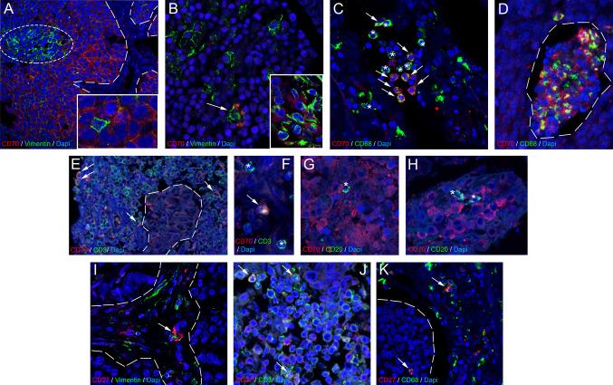 https://cdn.ncbi.nlm.nih.gov/pmc/blobs/091c/11981989/932da5a7b9ac/262_2025_4006_Fig4_HTML.jpg