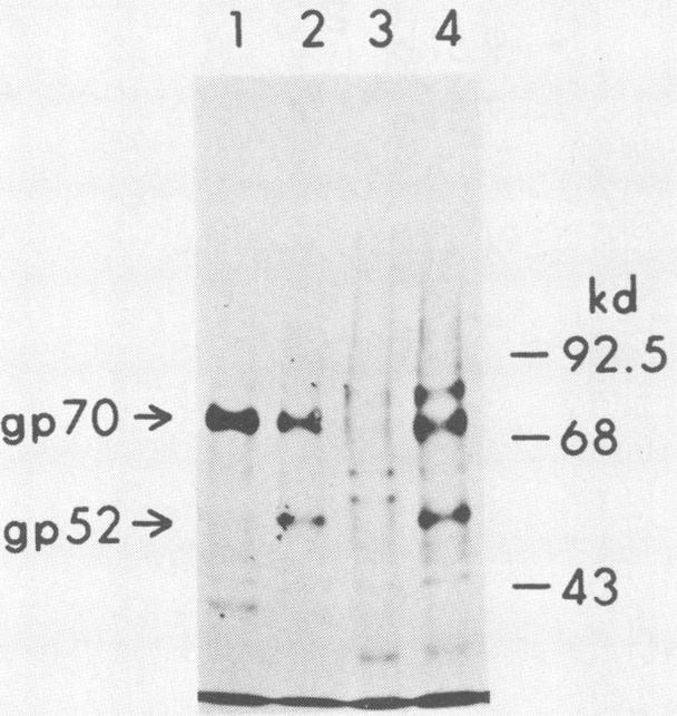 https://cdn.ncbi.nlm.nih.gov/pmc/blobs/091d/250562/b48f55ed5804/jvirol00081-0160-a.jpg
