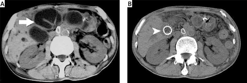 https://cdn.ncbi.nlm.nih.gov/pmc/blobs/091d/4520836/1b1ee0ac7e6d/WIITM-10-25187-g002.jpg