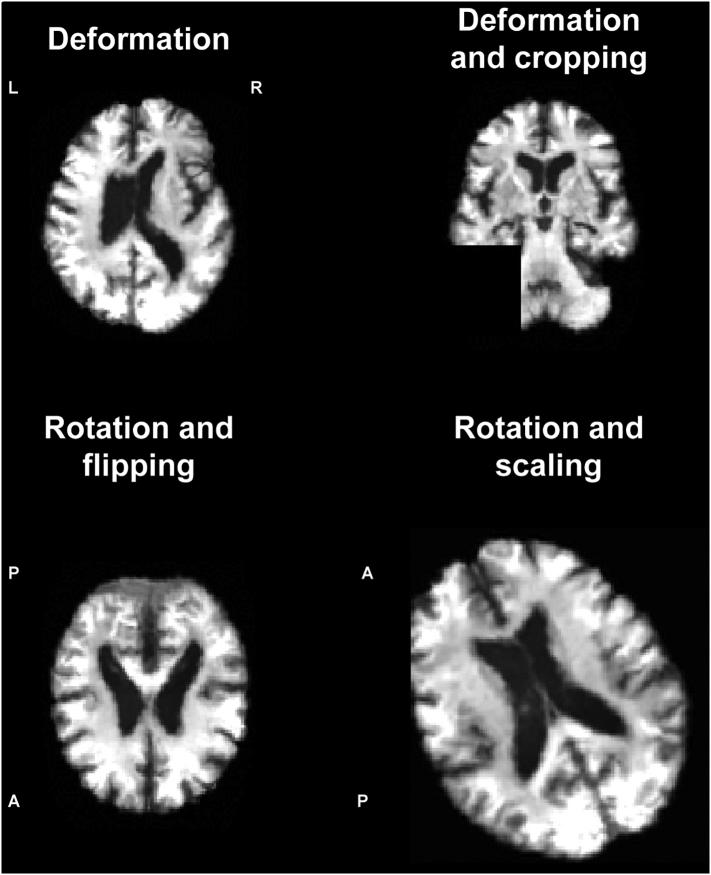 https://cdn.ncbi.nlm.nih.gov/pmc/blobs/0923/6413333/15ced53c8a59/gr3.jpg