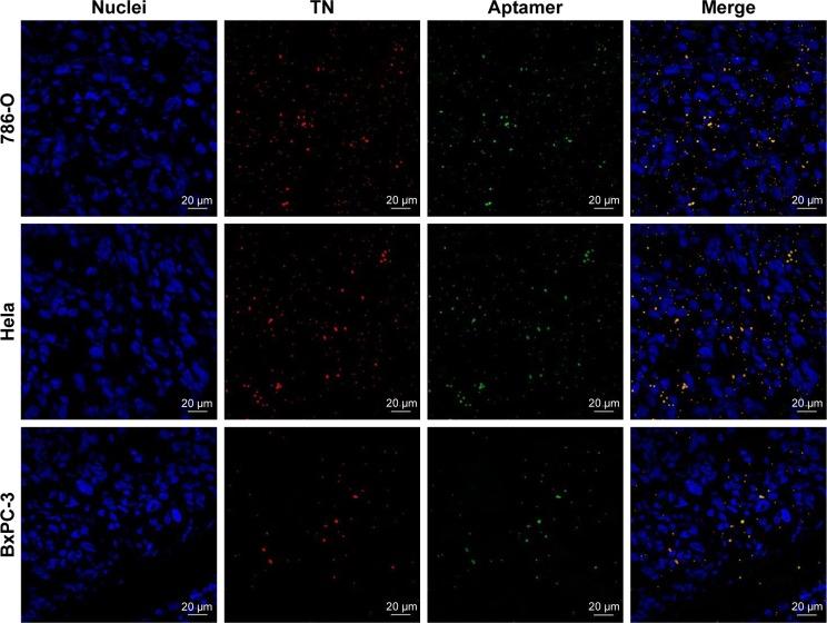 https://cdn.ncbi.nlm.nih.gov/pmc/blobs/0927/6199208/35b38fe3f4c7/ijn-13-6481Fig8.jpg