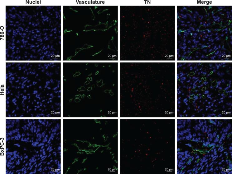 https://cdn.ncbi.nlm.nih.gov/pmc/blobs/0927/6199208/3b91d4d86dbd/ijn-13-6481Fig7.jpg