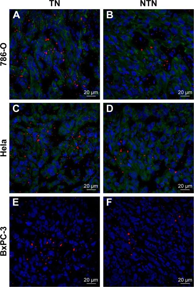 https://cdn.ncbi.nlm.nih.gov/pmc/blobs/0927/6199208/5043aca29edf/ijn-13-6481Fig9.jpg