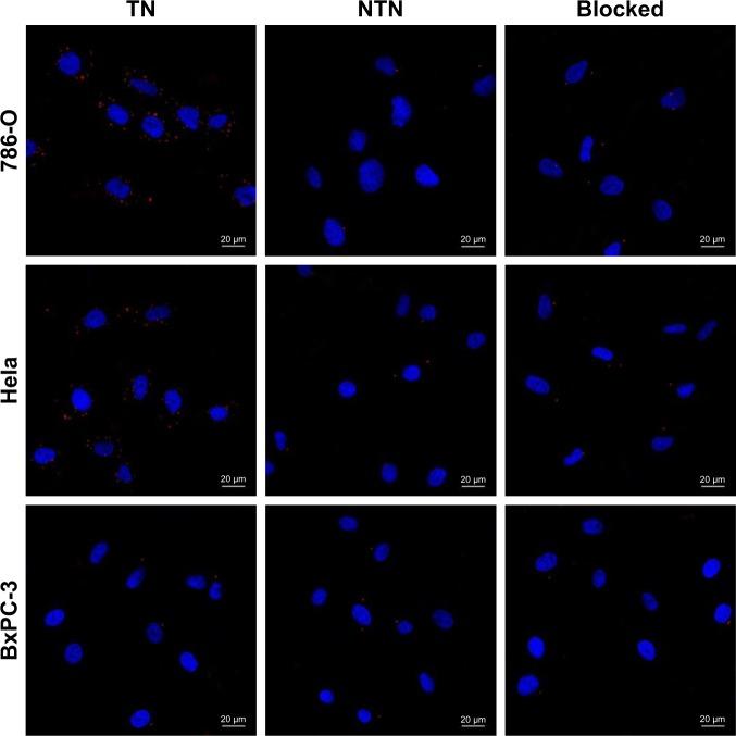 https://cdn.ncbi.nlm.nih.gov/pmc/blobs/0927/6199208/fd2557e3261f/ijn-13-6481Fig4.jpg