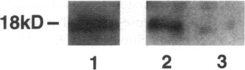 https://cdn.ncbi.nlm.nih.gov/pmc/blobs/092b/296288/ae6641b6656b/jcinvest00019-0133-a.jpg