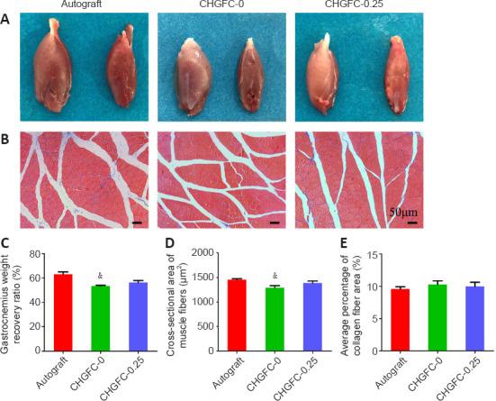 https://cdn.ncbi.nlm.nih.gov/pmc/blobs/093b/9241416/df8430afb796/NRR-18-207-g007.jpg