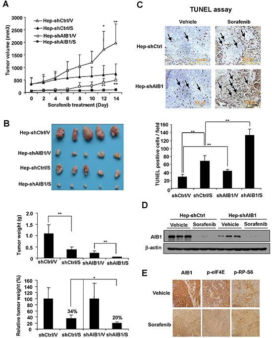 https://cdn.ncbi.nlm.nih.gov/pmc/blobs/093e/5045420/3106c4c7ee2f/oncotarget-07-29605-g007.jpg