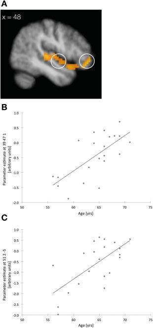 https://cdn.ncbi.nlm.nih.gov/pmc/blobs/094a/6867548/03a2d582a1a0/HBM-37-54-g005.jpg