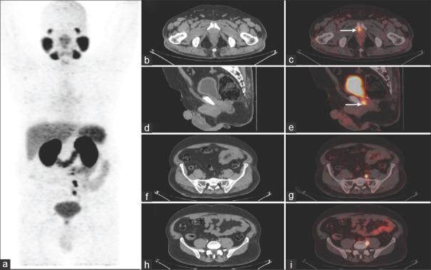 https://cdn.ncbi.nlm.nih.gov/pmc/blobs/094d/7531378/8d2e391551db/IJU-36-191-g001.jpg