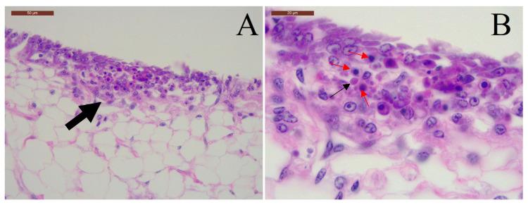 https://cdn.ncbi.nlm.nih.gov/pmc/blobs/0953/7551232/60f7aa6284e8/viruses-12-01030-g001.jpg